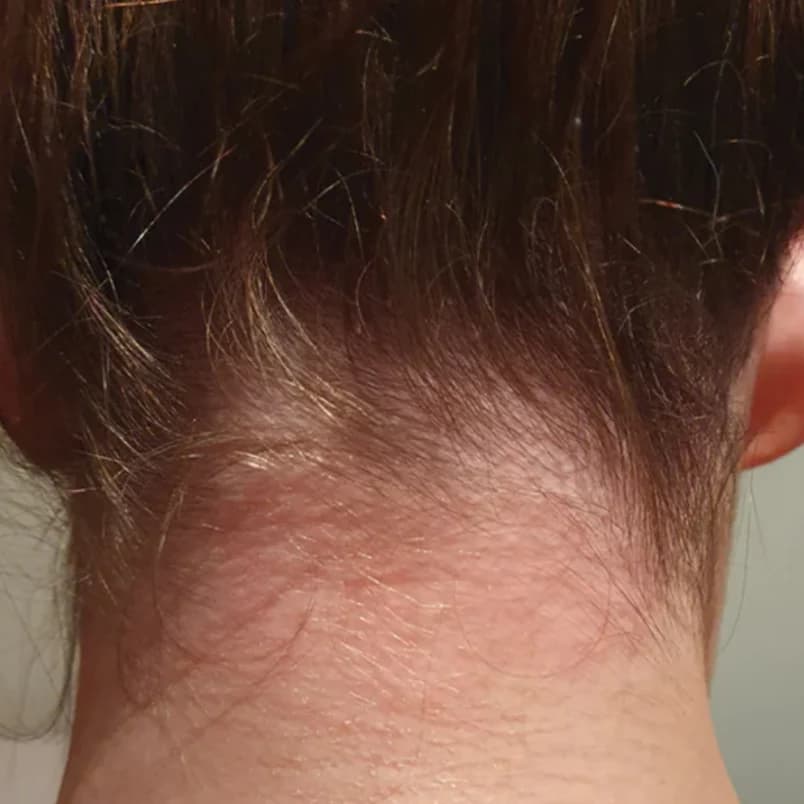 Calm, clear scalp after using The Daily Wash