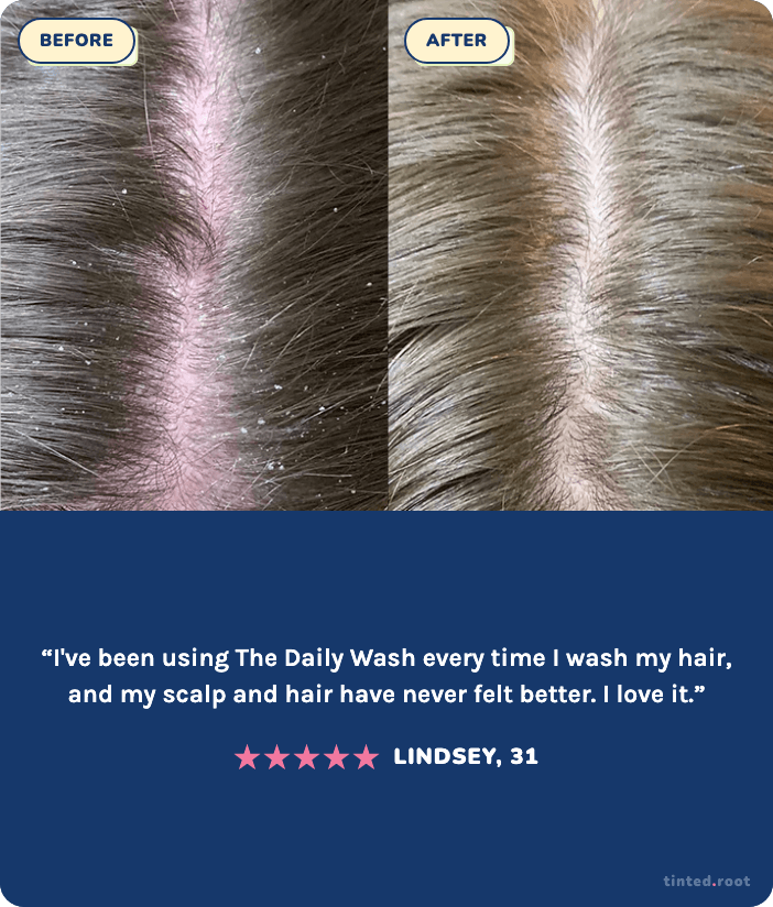 Before and after using The Daily Wash — Lindsey, 31