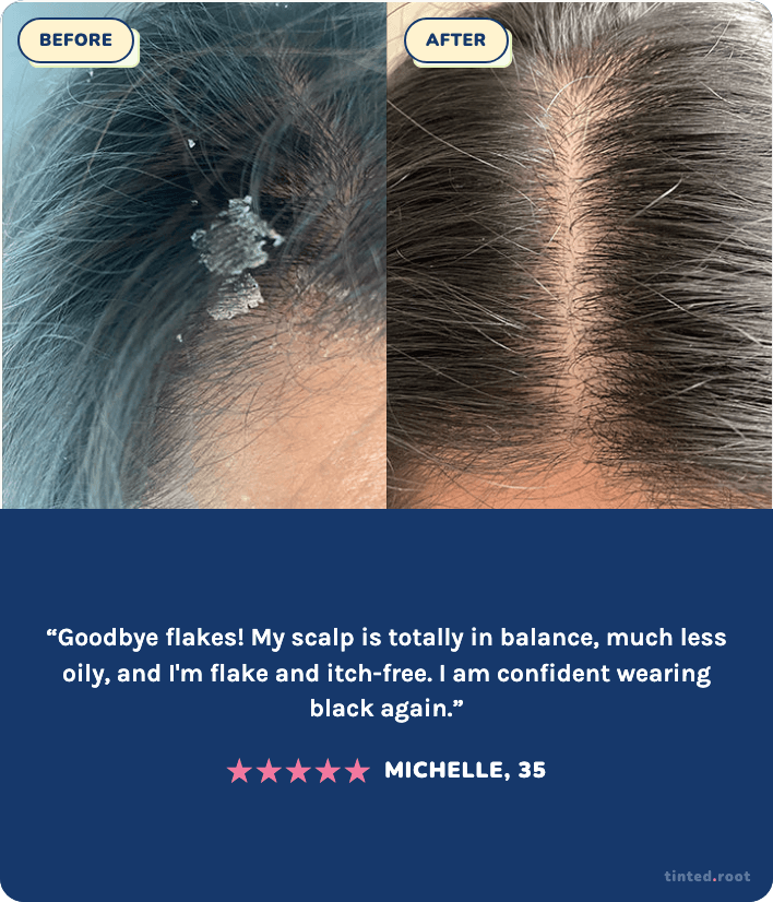 Before and after using The Daily Wash — Michelle, 35