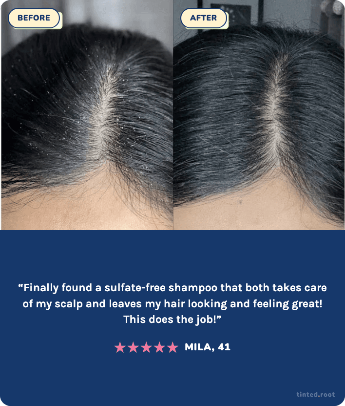 Before and after using The Daily Wash — Mila, 41