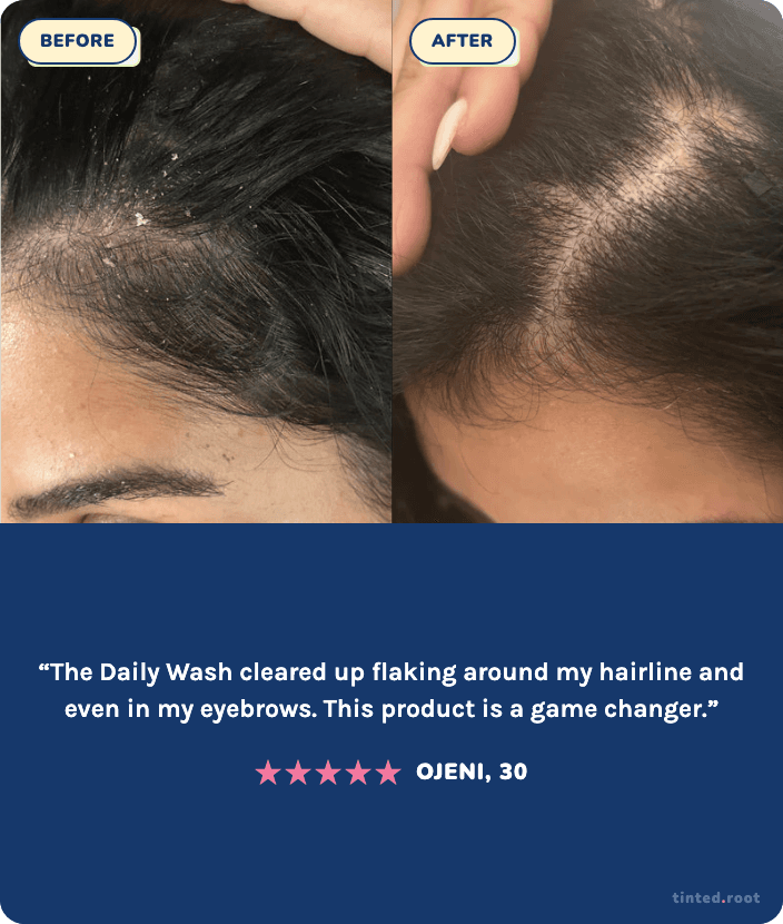 Before and after using The Daily Wash — Ojeni, 30