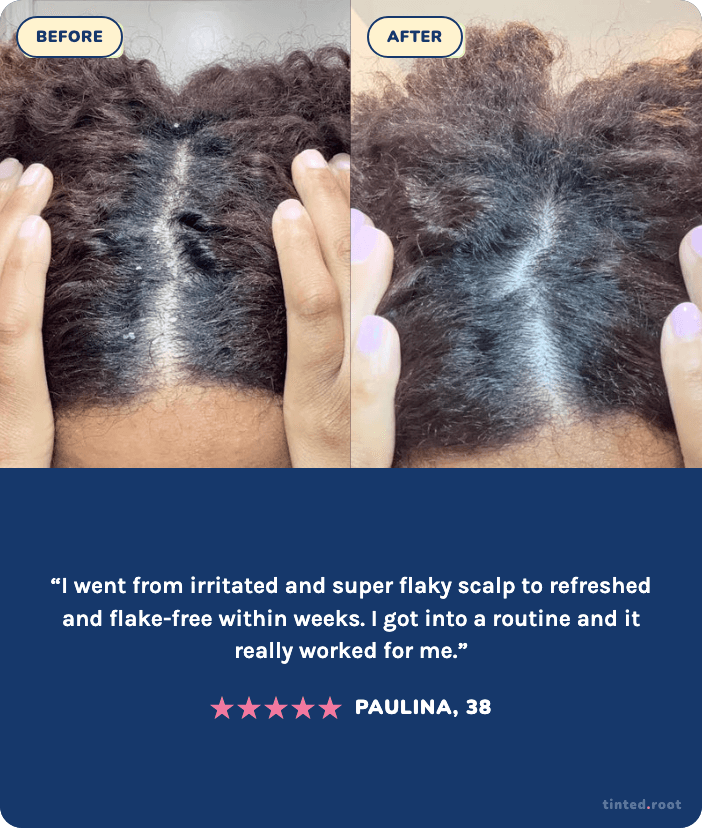 Before and after using The Daily Wash — Paulina, 38